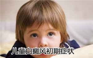 白癜风病因
